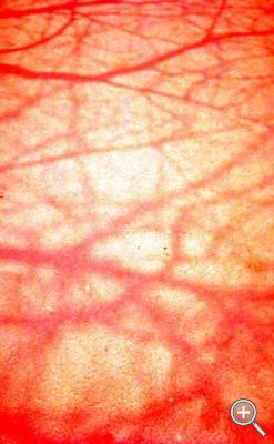 Klicka fÃ¶r stÃ¶rre